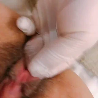 주먹 쑤시기ㅜㅜ